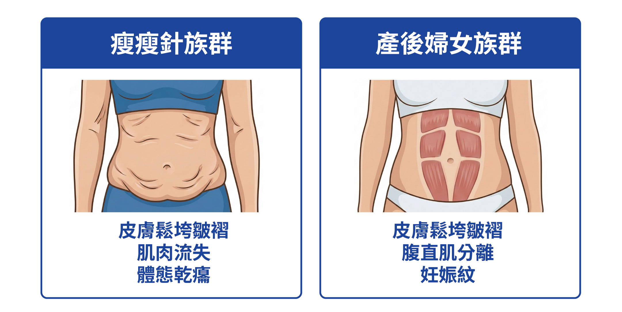 瘦瘦針族群皮膚鬆垮與肌肉流失；產後婦女腹直肌分離與妊娠紋。